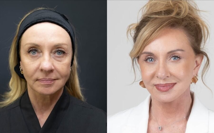 “Bem-vindos ao luxo”: facelift reforça imagem de corretora de alto padrão